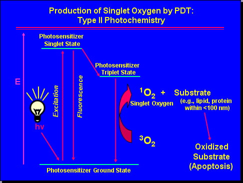 Photodynamic Therapy