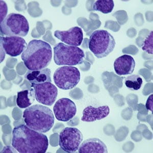 myeloid cell