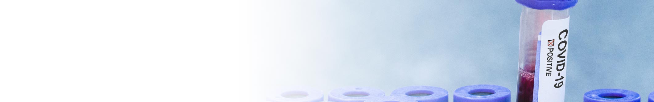 vials