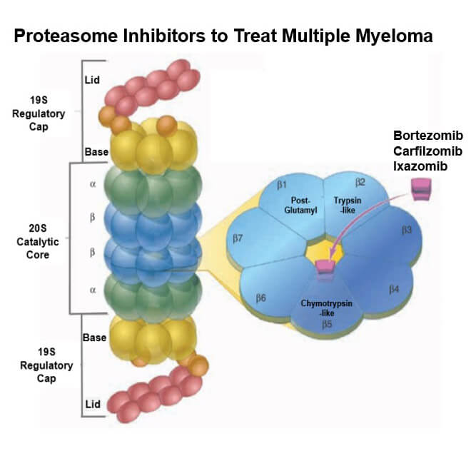 myeloma