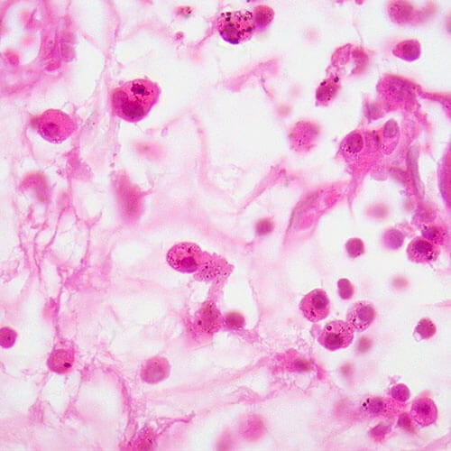 plasma cells
