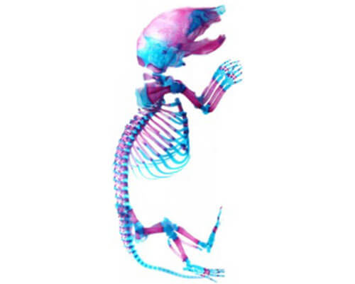 skeleton
