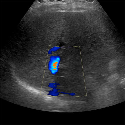ultrasound