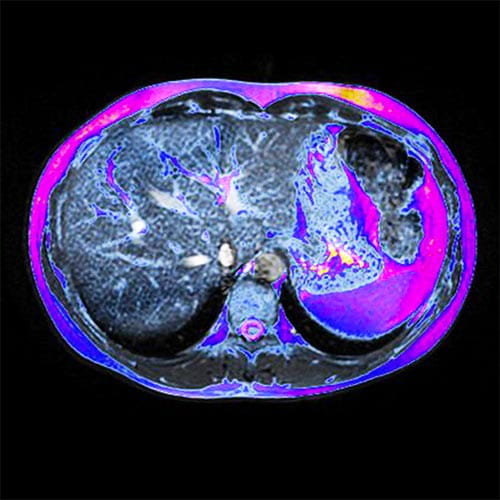 abdominal imaging