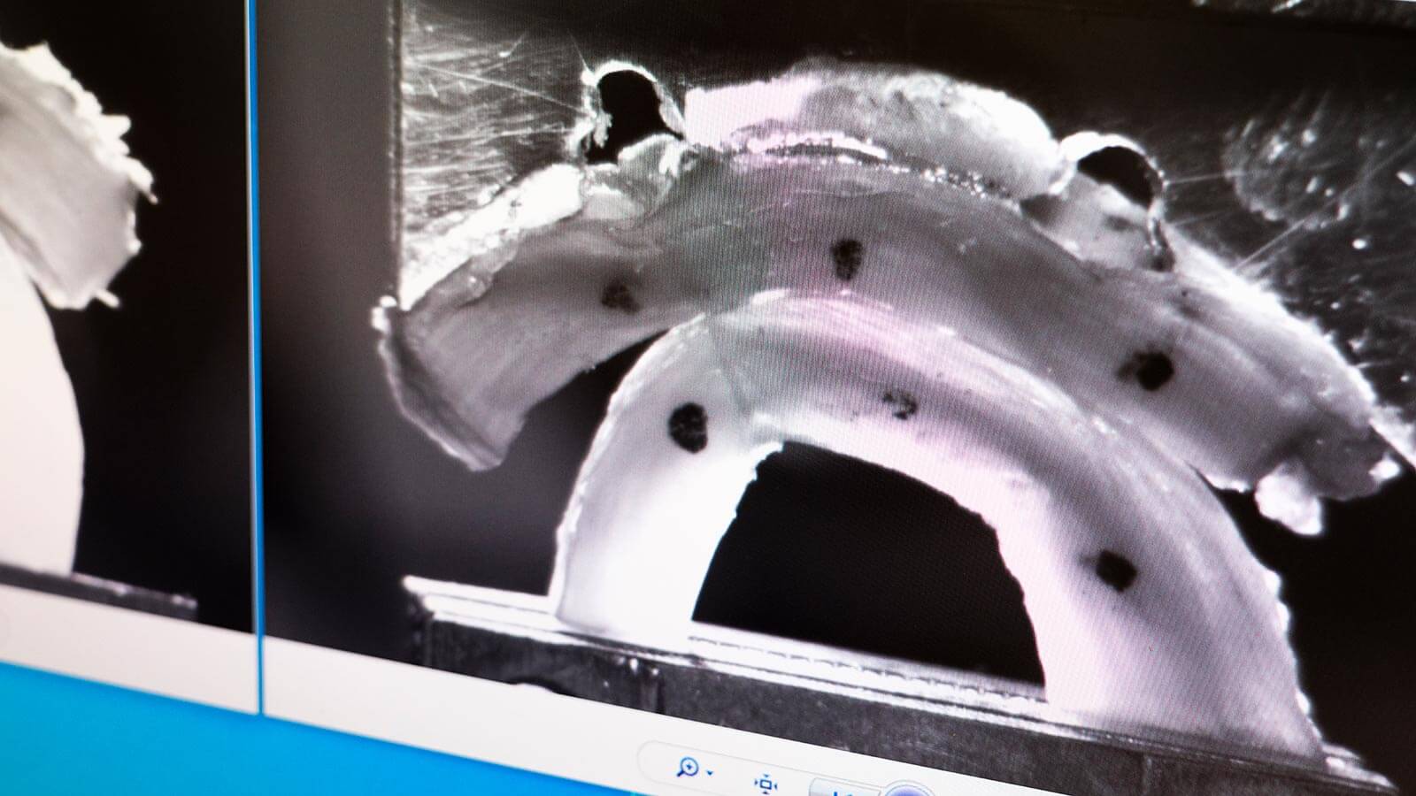 medical scan