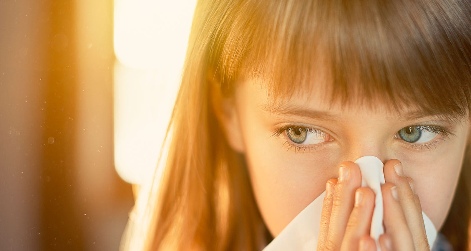 A young girl with an allergic reaction is holding a tissue