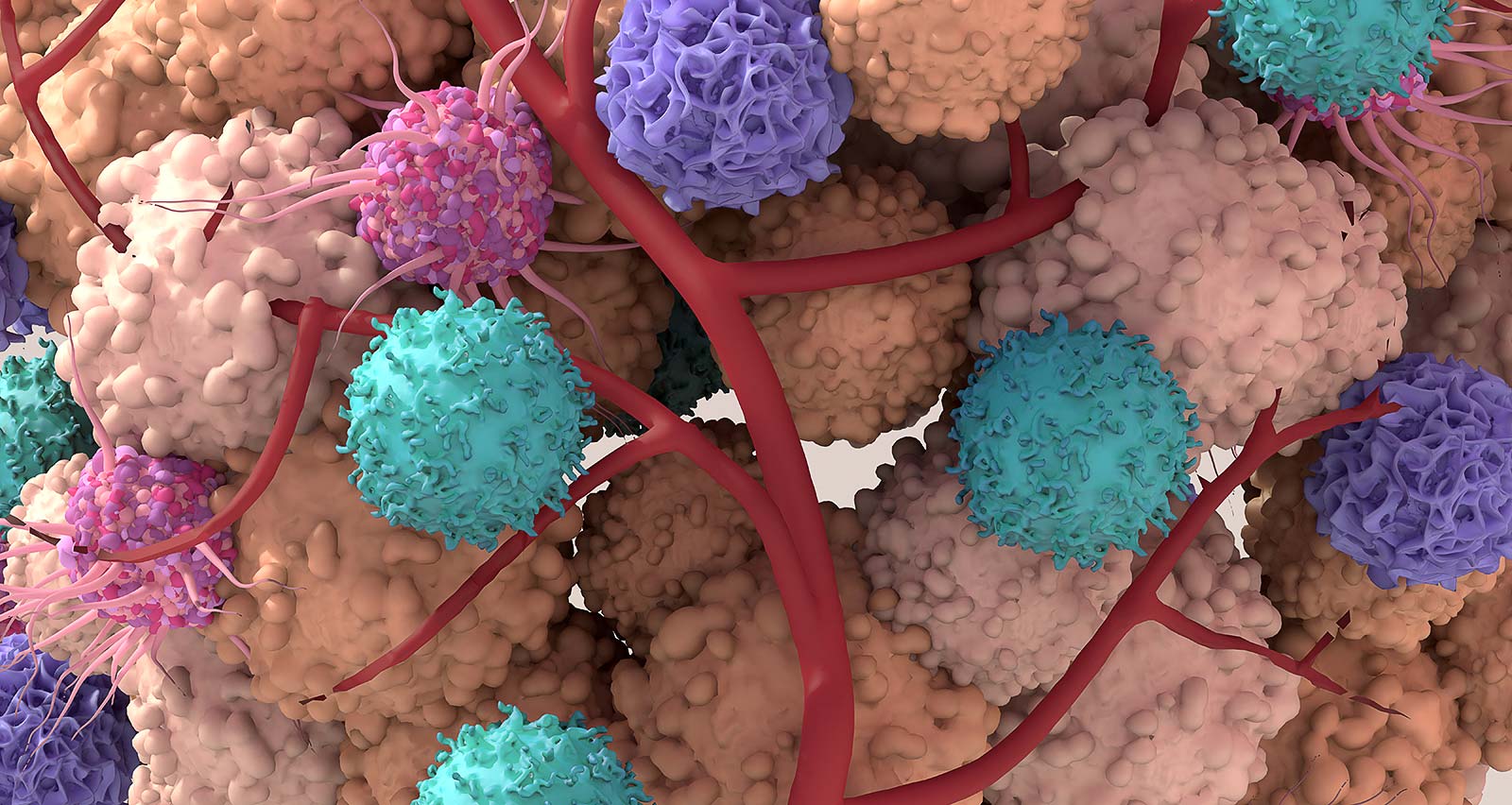 Illustration of tumor microenvironment