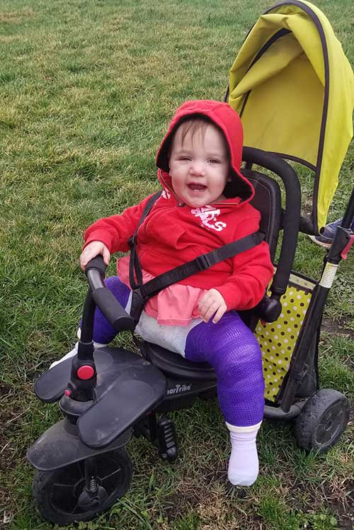 Toddler Sawyer after Hip Dysplasia surgery