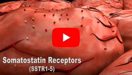 Click to watch the Diagnosing Neuroendocrine Tumors video