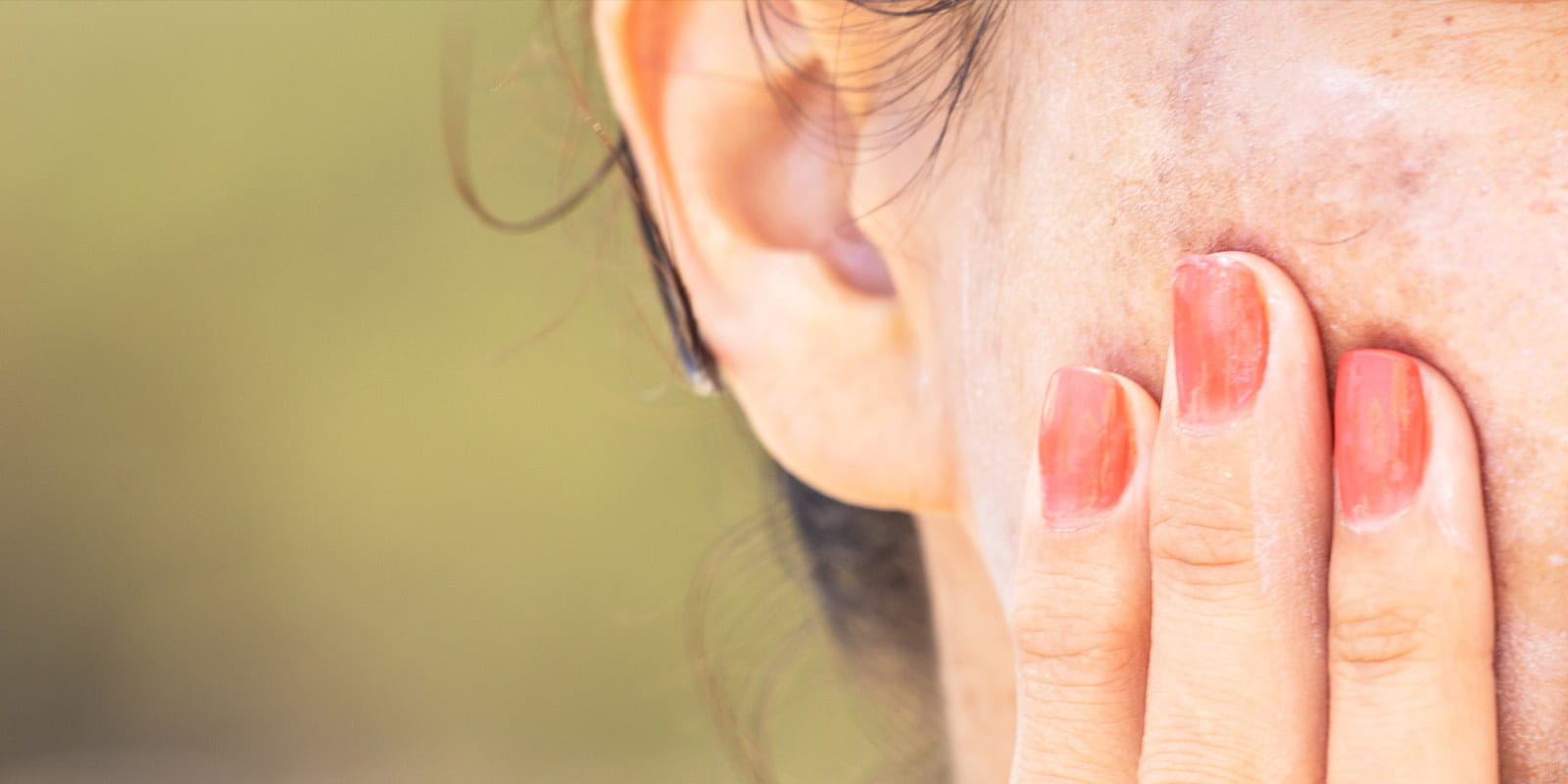 Pigmented spots on the face of a middle-aged woman.