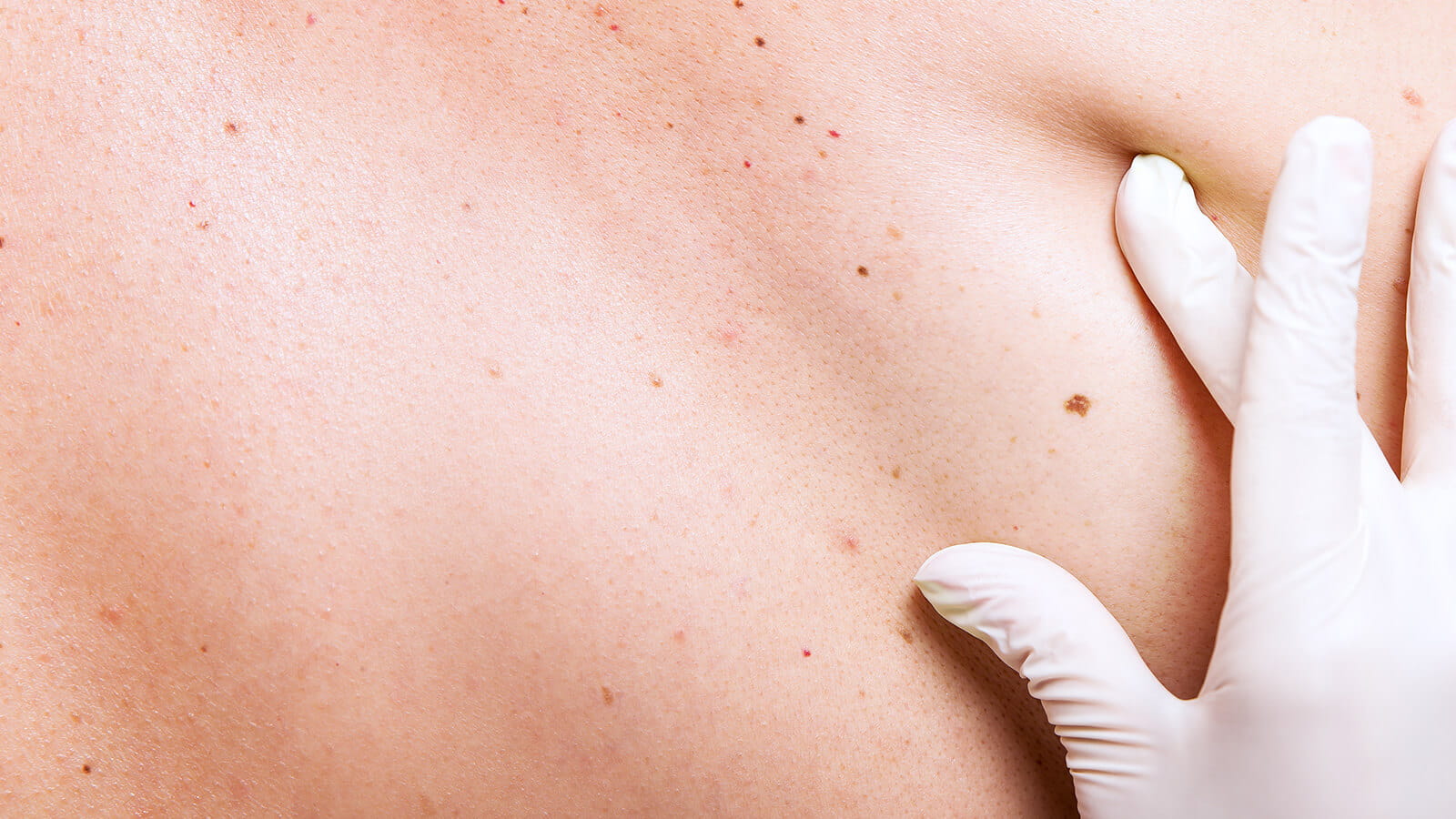 Skin Examination