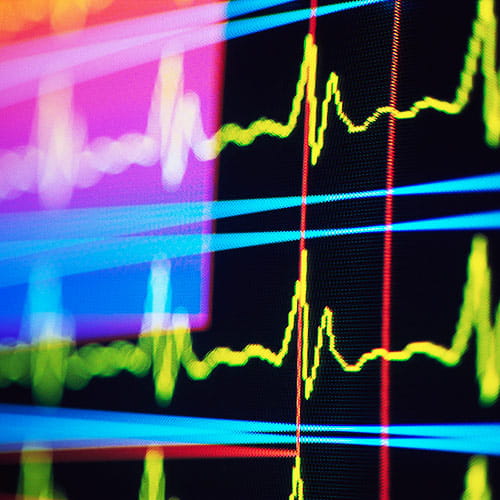 Heart Rate Monitor