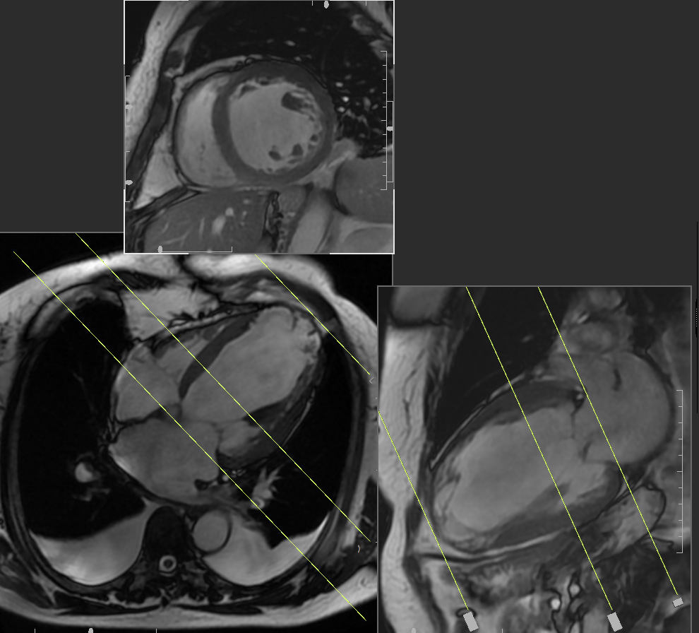 heart-imaging-lab-cmri