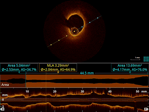 Animation of heart imaging