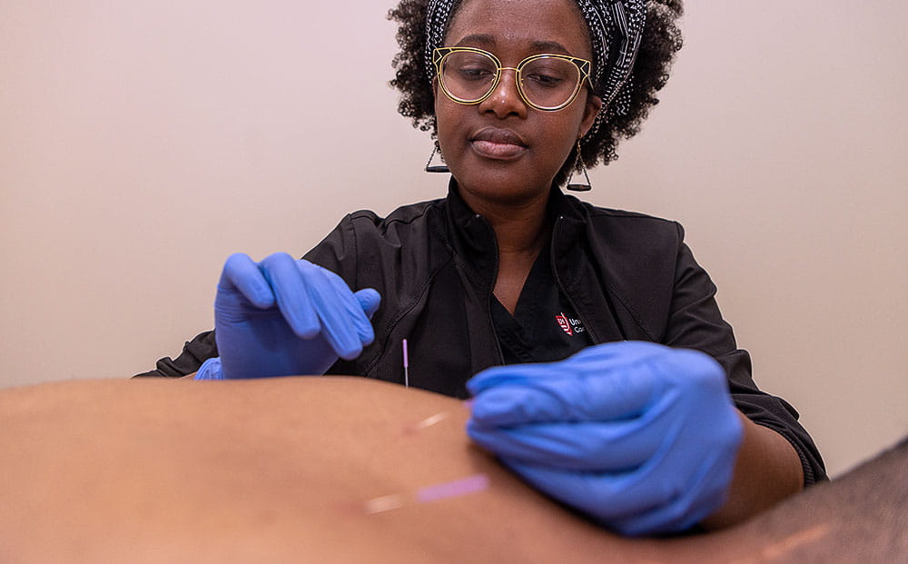 Joan Odhiambo provides acupuncture to a patient at UH Connor Whole Health in Beachwood