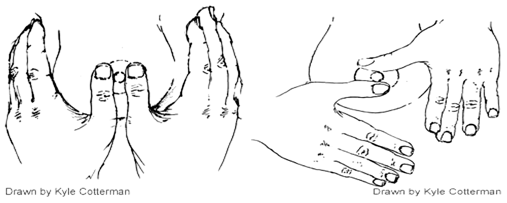 Illustration of two-step breast massage by Kyle Cotterman