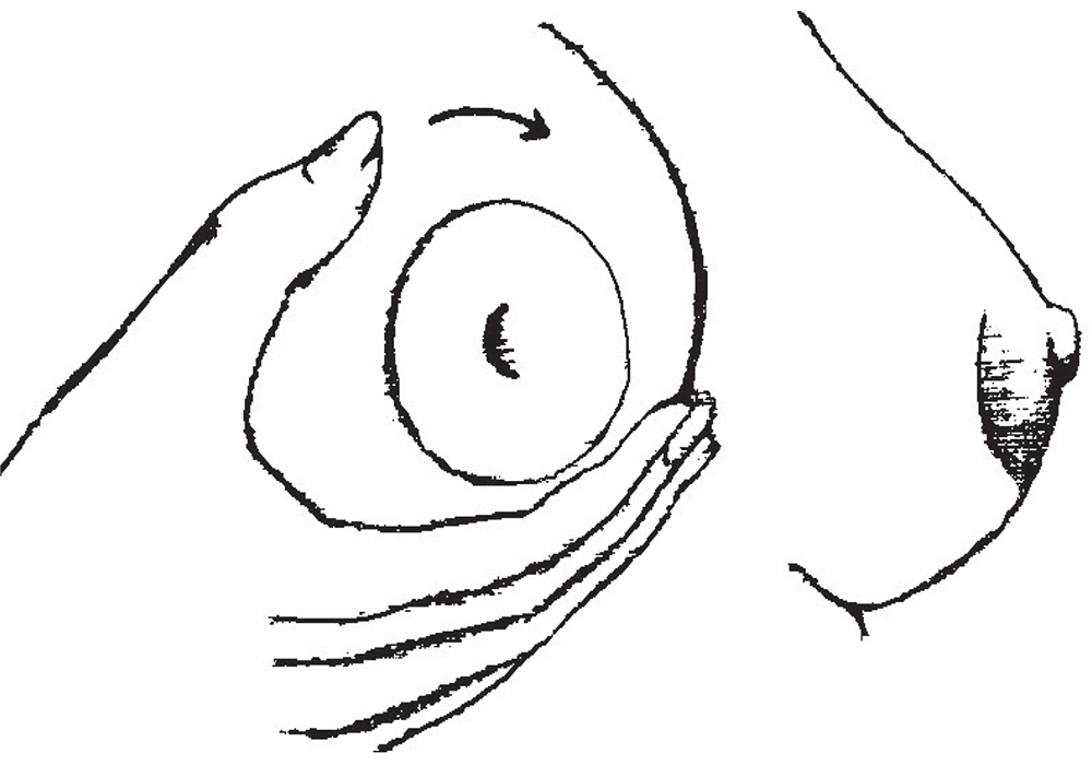 Illustration of manual breast massage by Kyle Cotterman