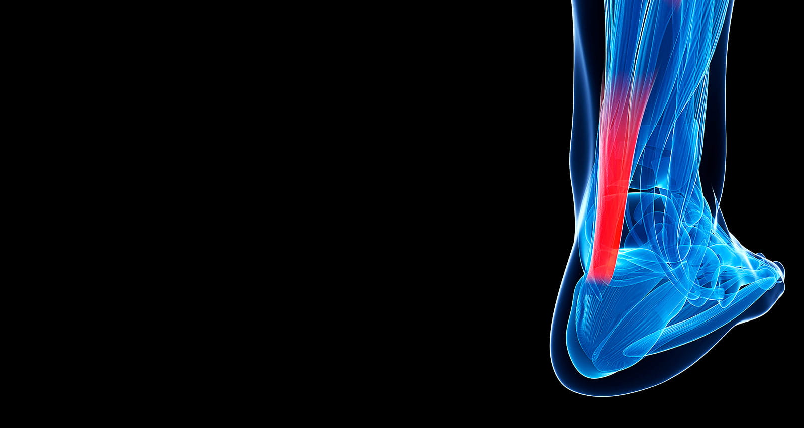 3d rendered illustration of the achilles tendon