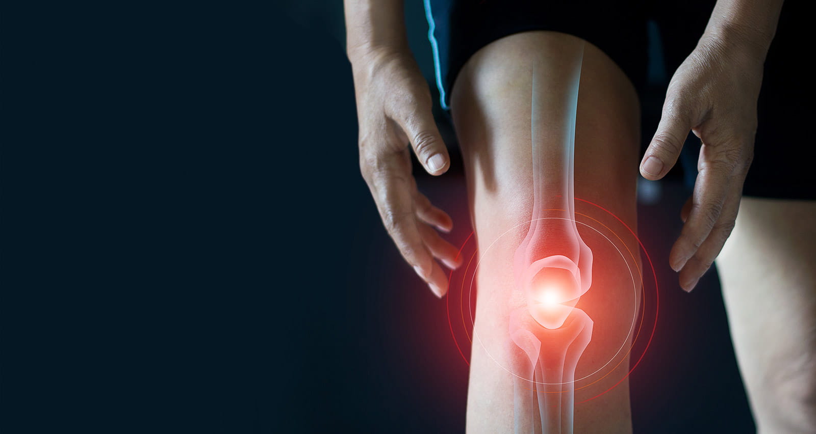 A person suffering from tendon problems and Joint inflammation touching their inflamed knee