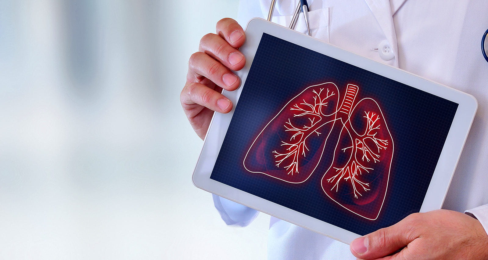 Doctor showing a picture of lungs on a tablet in a hospital