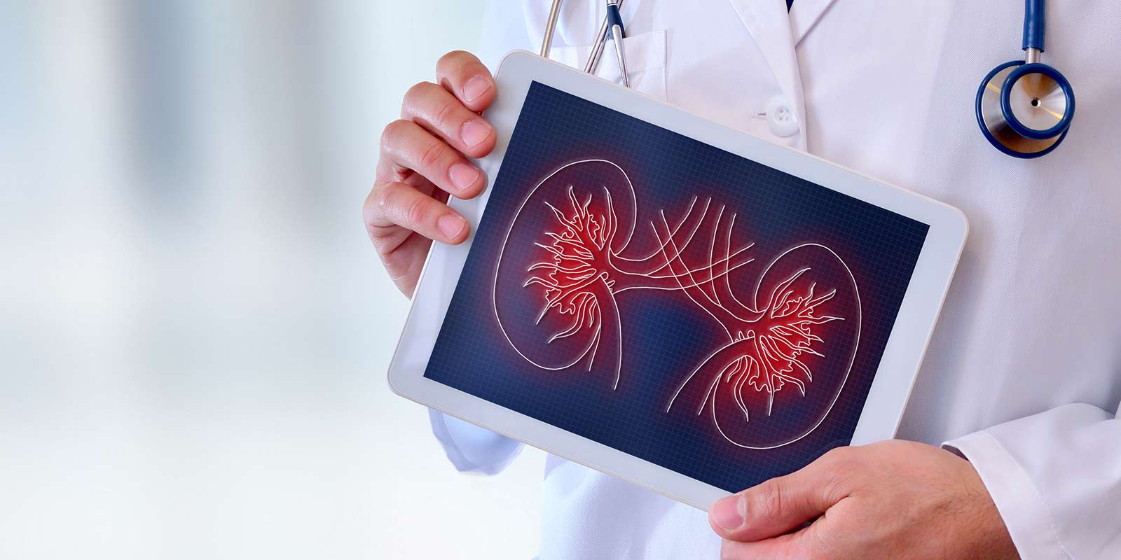 Doctor holding kidney diagram for patient.